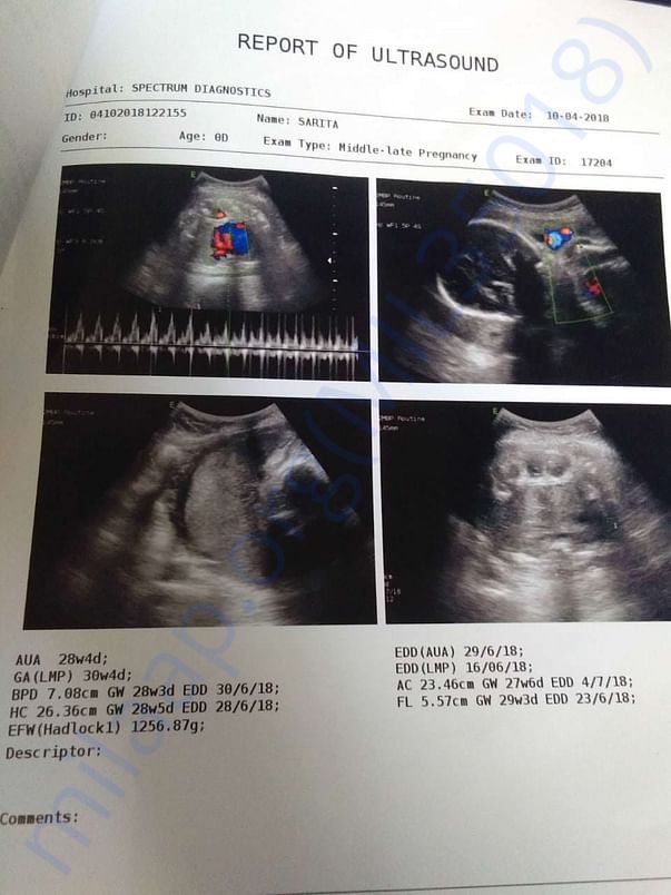 Ultra Sound Report
