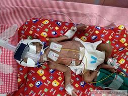They Begged To Save Their Baby, But It Isn’t Enough To Save Her