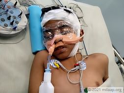 8-year-old Nihit is in a critical condition in the ICU and needs help