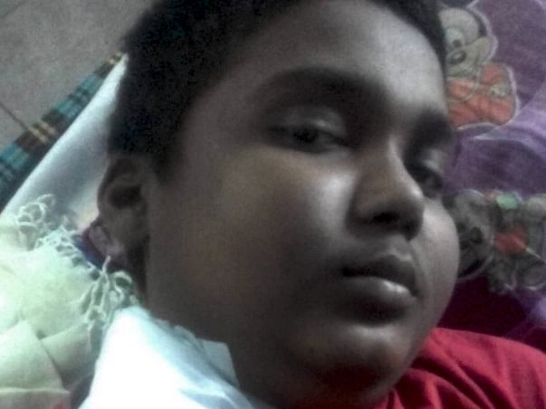 Help Young Bittu Undergo Kidney Transplant