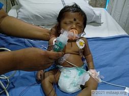 This one-month-old baby needs a heart surgery to survive