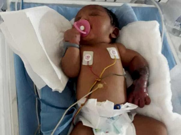 Help This New Born Whose Left Limb Is Infected By Gangrene Since Birth