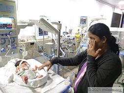 These Parents Are Struggling To Keep Their Twin Babies Alive