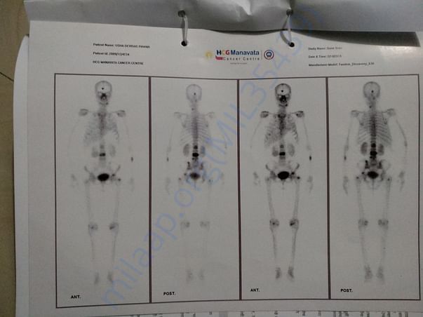 Bone Scan report 2