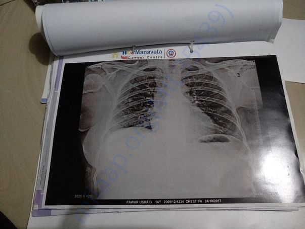 24.10.2017 Lungs Xray