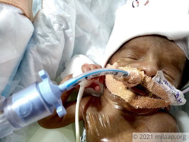 Help Stuti and Anurag save their premature baby boy