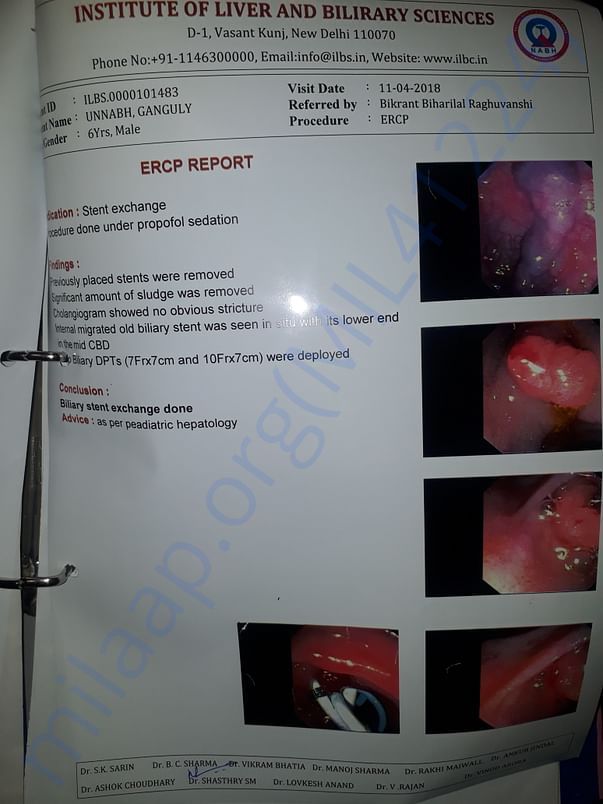 LATEST ERCP(STENT EXCHANGE) REPORT