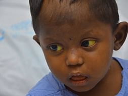 Help 4-Year-Old Who Scratches Skin and Pulls Hair Out In Pain