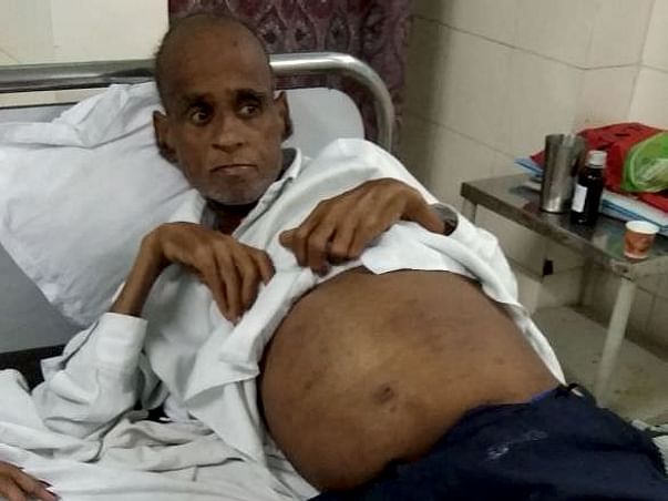Need Financial Help For My Father's Treatment Of Kidney Failure