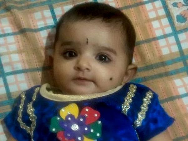 Help Jeevitha(6 Month Old Baby)suffering From Atypical HUS