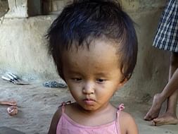 Help Reshmi fight Hydrocephalus