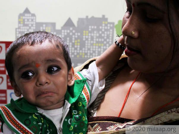 This Baby Gasps For Breath Every Single Day Due To Large Hole In Heart