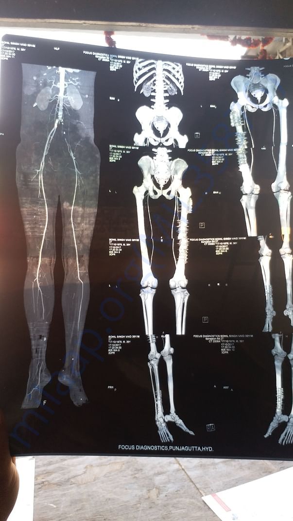 Xray