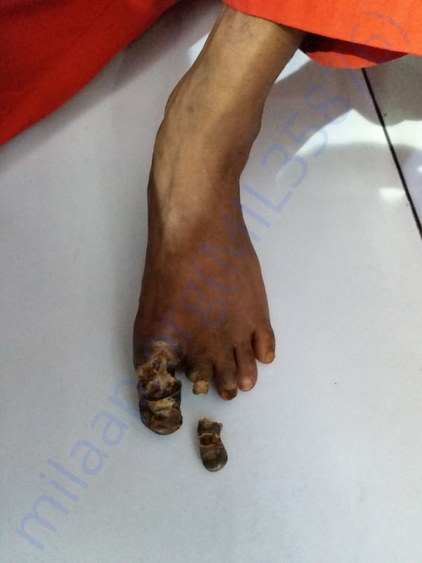Left leg image