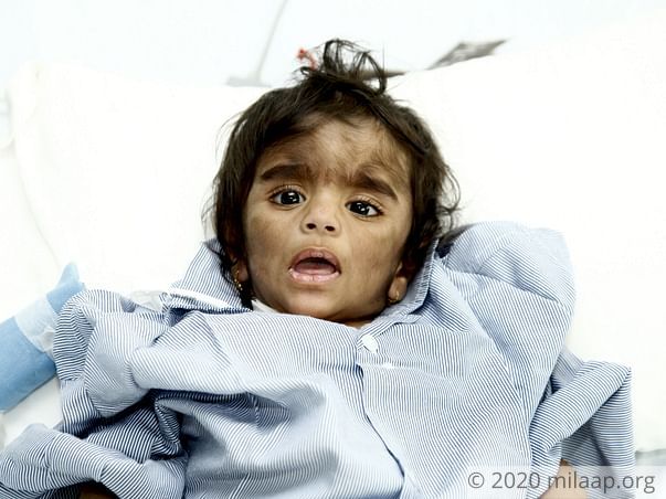 This 1-year-old boy needs a bone marrow transplant to survive