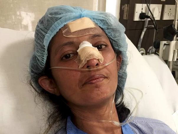 Help Dipti Joshi Fight Scleroderma