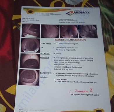 Colonoscopy Report