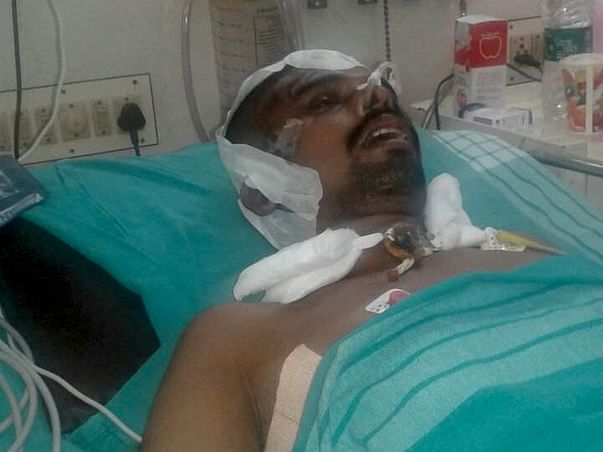 To Help 35 Year-Old to Recover from a Severe Accident Injury