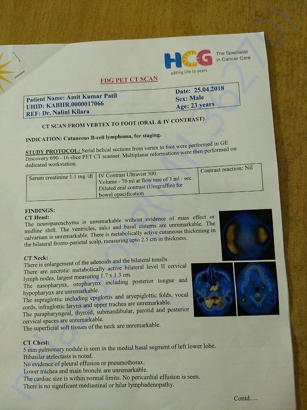 CT Scan reports 1