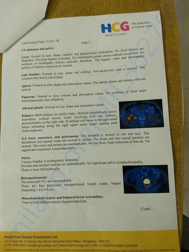 CT Scan report 2