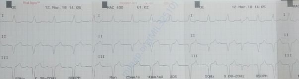 ECG Report - 01