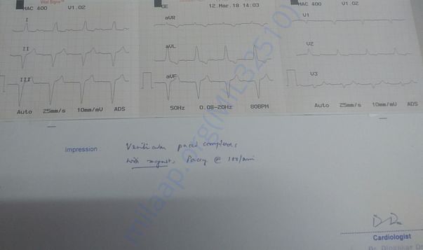 ECG - 06