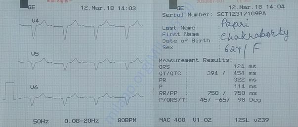 ECG - 07