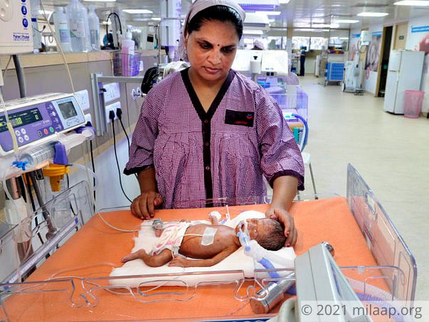 This Newborn Cannot Survive Without 6 Weeks Of Life Support