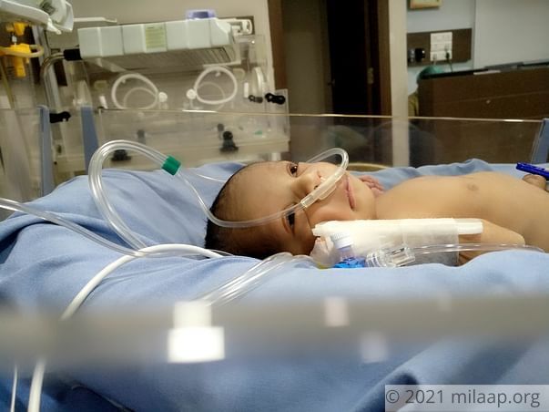 4-day-old Baby Will Suffocate To Death Unless He Has A Surgery
