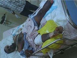 Help Venkatasubbaiah Who Got Electrocuted In Fire Accident.
