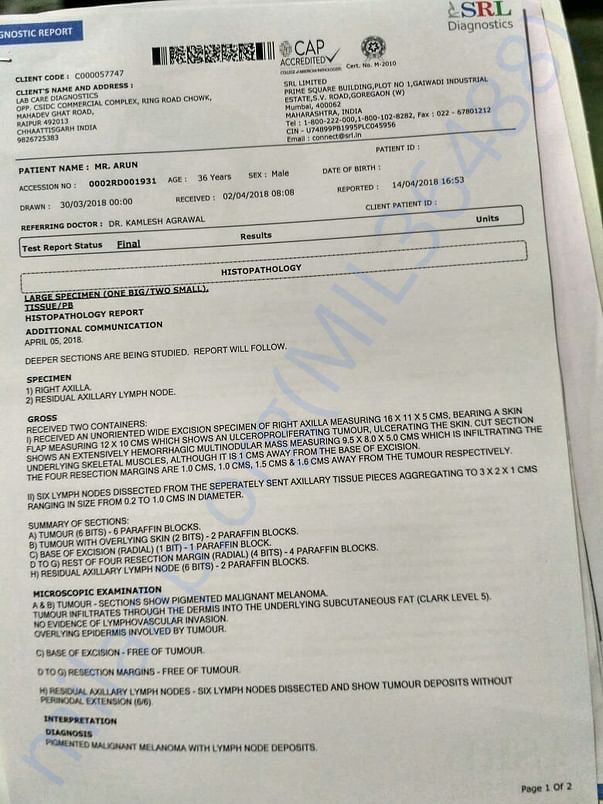 Biopsy report confirming malignant melanoma. See Last line
