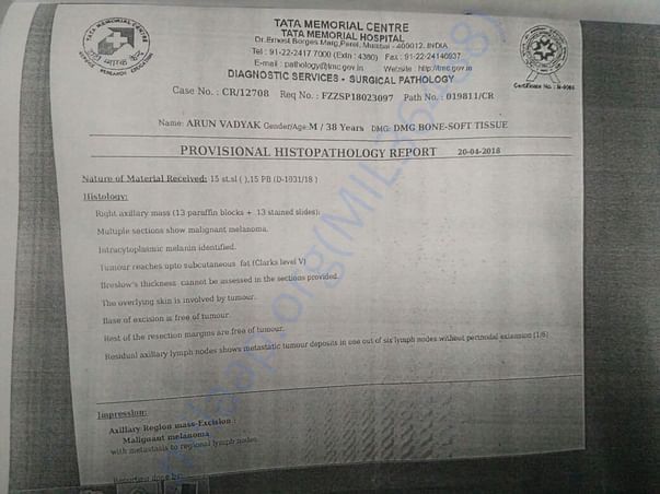 TMCH Histopathology report confirming Malignant Melanoma in last line