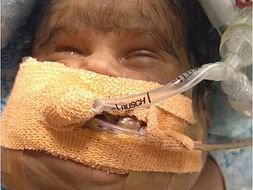 Help Baby Of Pushpa To Survive A Rare Condition