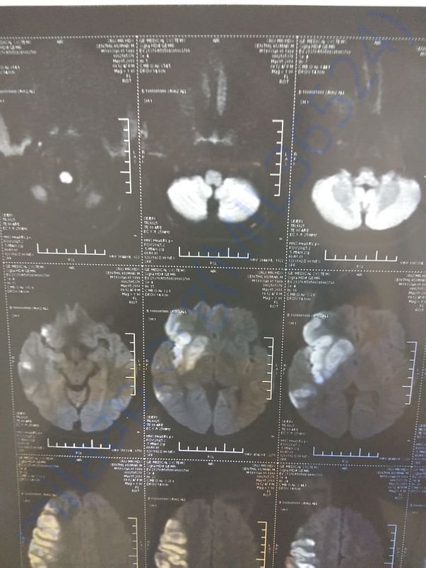 Scan Report