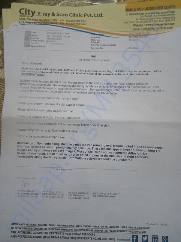 MRI-Brain report