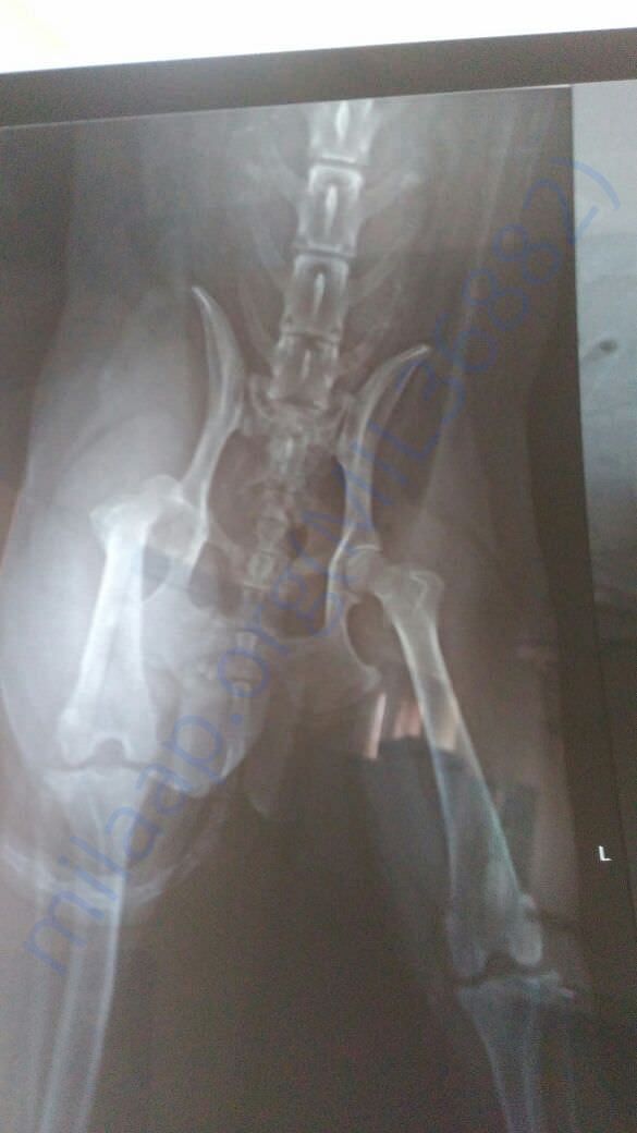 Xray