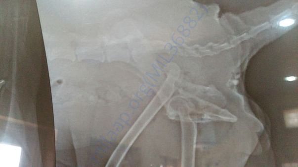 Xray