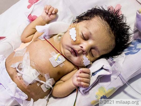 This Baby Boy Born Without Food Pipe Will Die Without Treatment