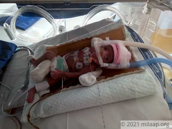 This 1/2kg Baby Girl Is A Fighter Who Is Beating Odds To Survive