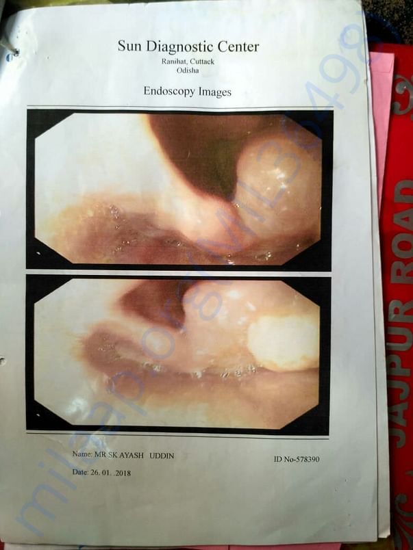 Endoscopy Images