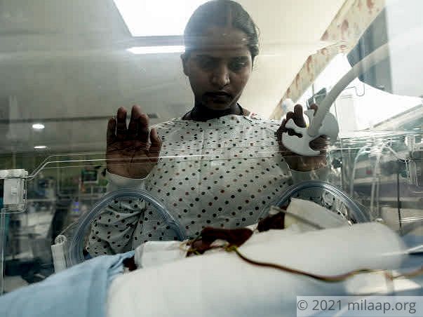20-Day-Old Baby Girl Can Only Survive With NICU Treatment