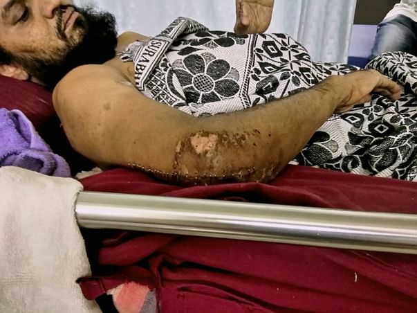 Help Adil Stand-up in Life!