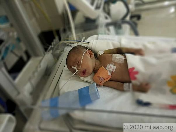Help 3-month-old Manak fight heart disease