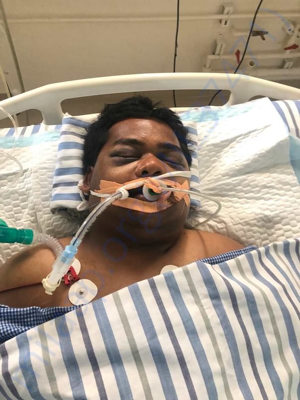 Condition at hospital