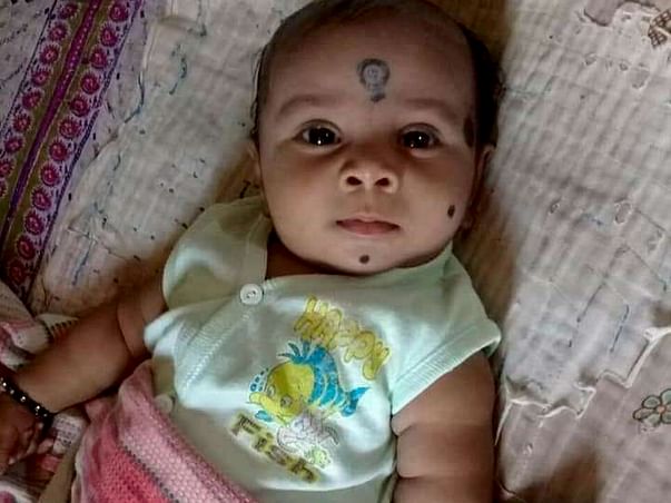 Help Baby Shiva Srinidh Kalakota Who Is Suffering From Kidney Ailment