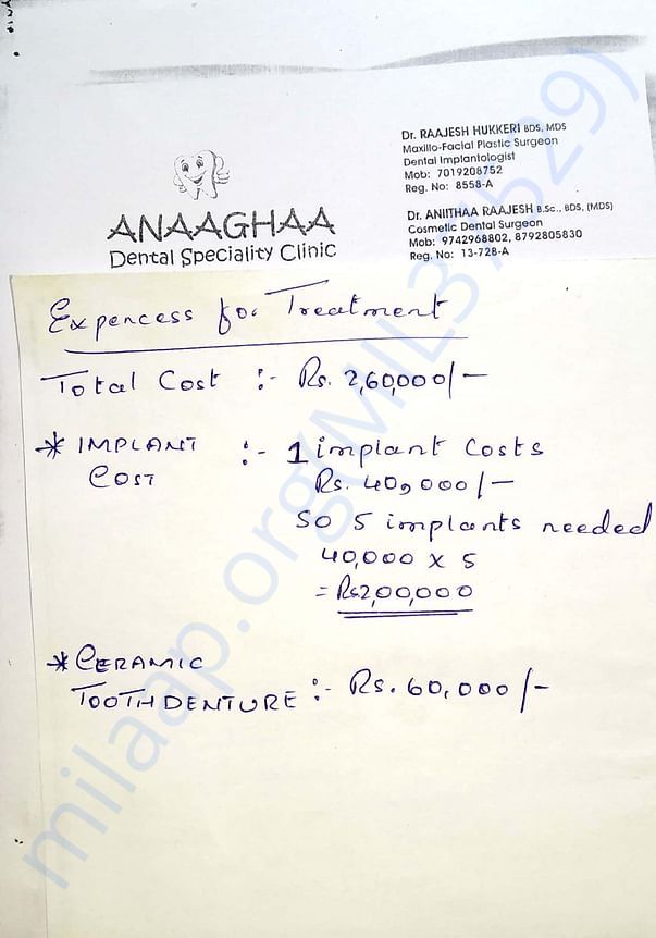 Tooth implant cost breakdown