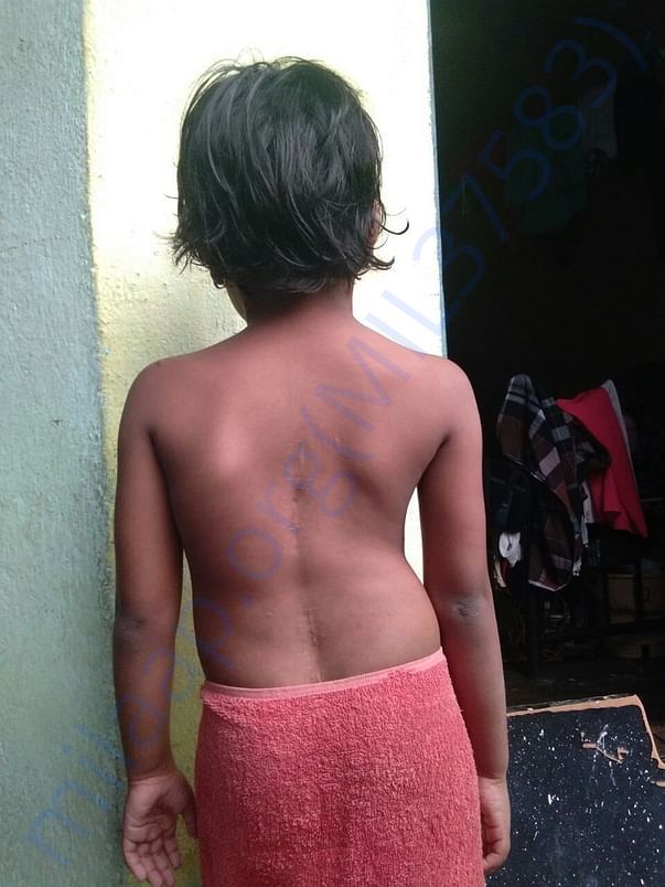 Ashiyas spine