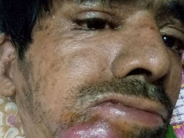 Help Sami Ulla Khan Fight Cancer