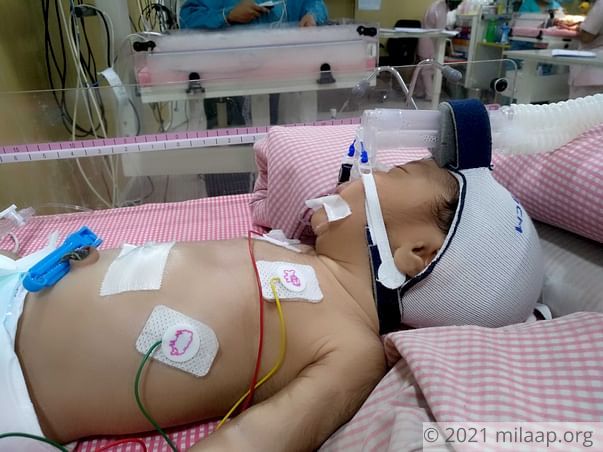 With A Mentally Ill Husband This Mother Is Struggling To Save Her Baby