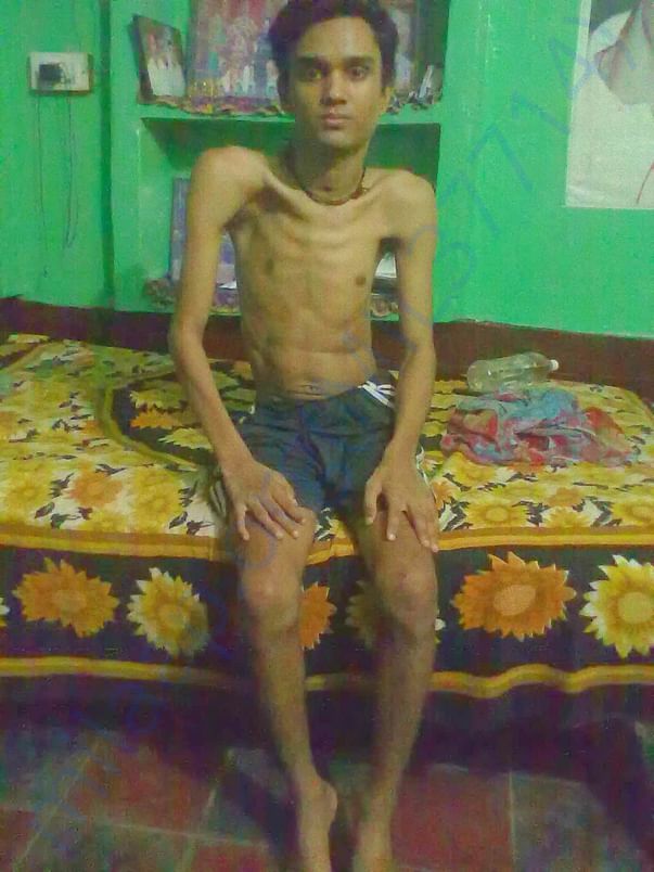 Sandeep rajak medical records